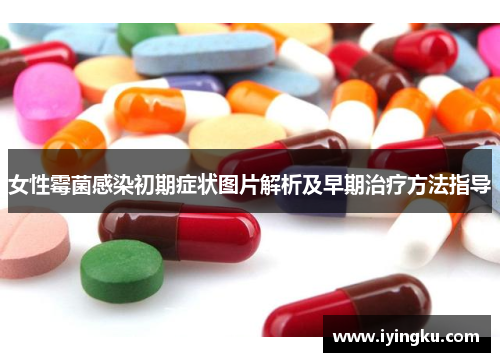 女性霉菌感染初期症状图片解析及早期治疗方法指导 女性霉菌感染初期症状图片解析及早期治疗方法指导