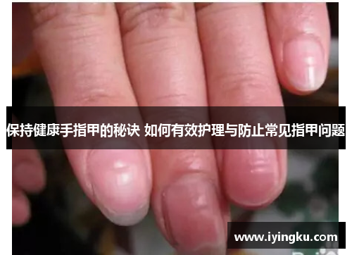 保持健康手指甲的秘诀 如何有效护理与防止常见指甲问题