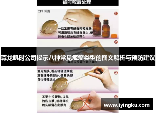 尊龙凯时公司揭示八种常见疱疹类型的图文解析与预防建议